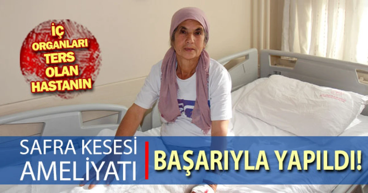 İç organları ters olan hastanın safra kesesi ameliyatı başarıyla yapıldı